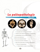 ÉPUISÉ - La paléopathologie, 2011, 180 p.